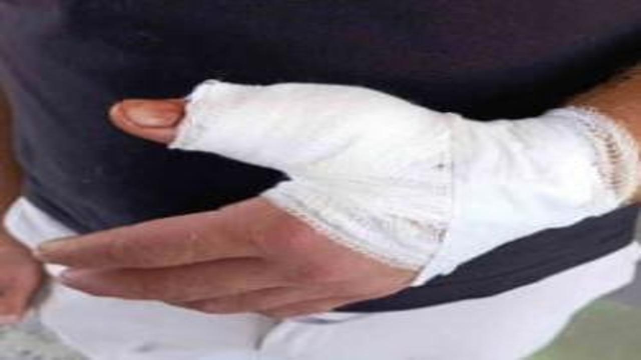 Bayramın ikinci gününde 869 kişi hastanelere başvurdu