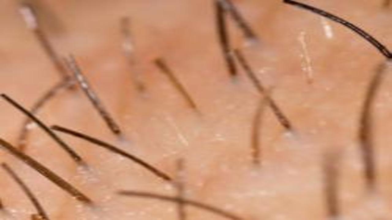 Kıl dönmesinde en büyük tehlike: Tekrarlaması