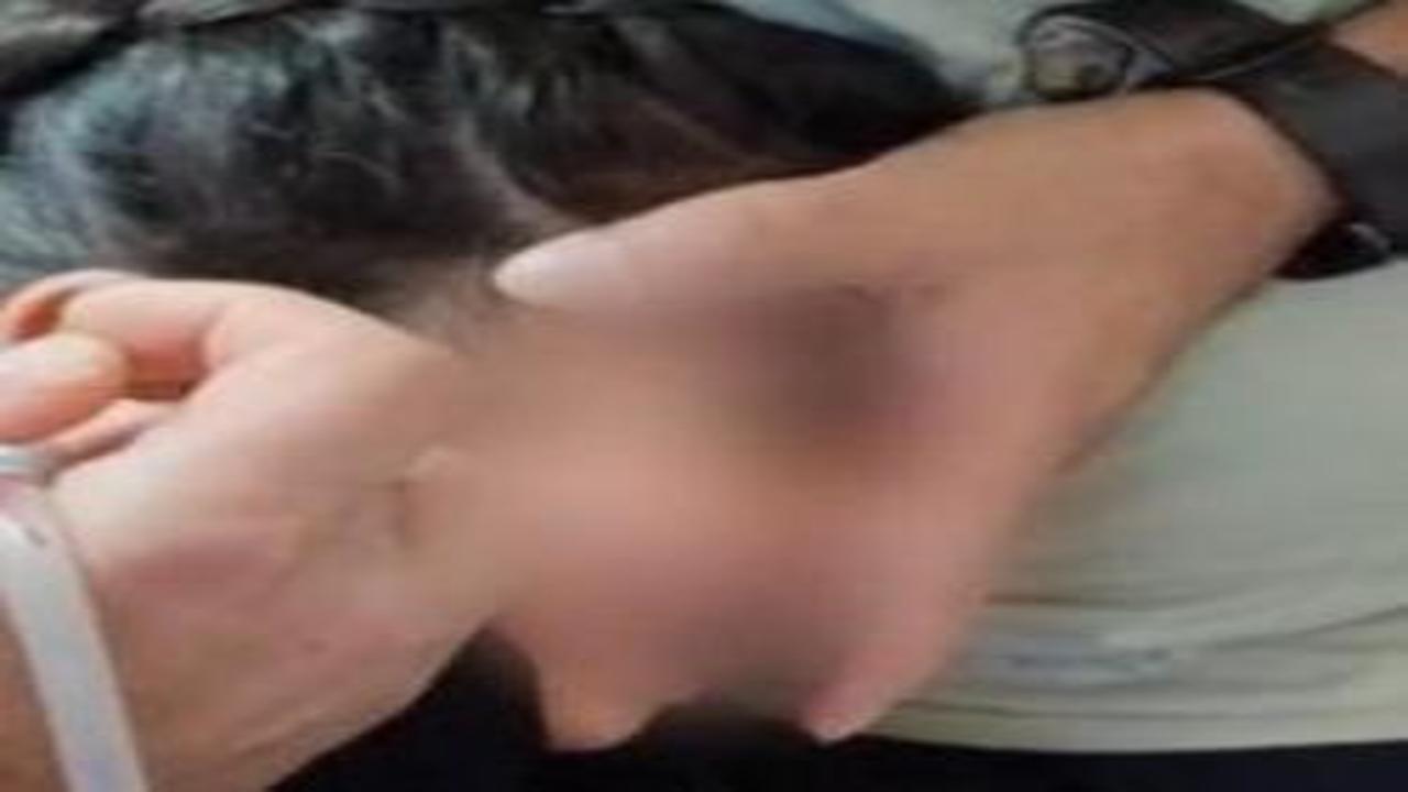 5 yaşındaki çocuğun kulağından canlı kene çıktı