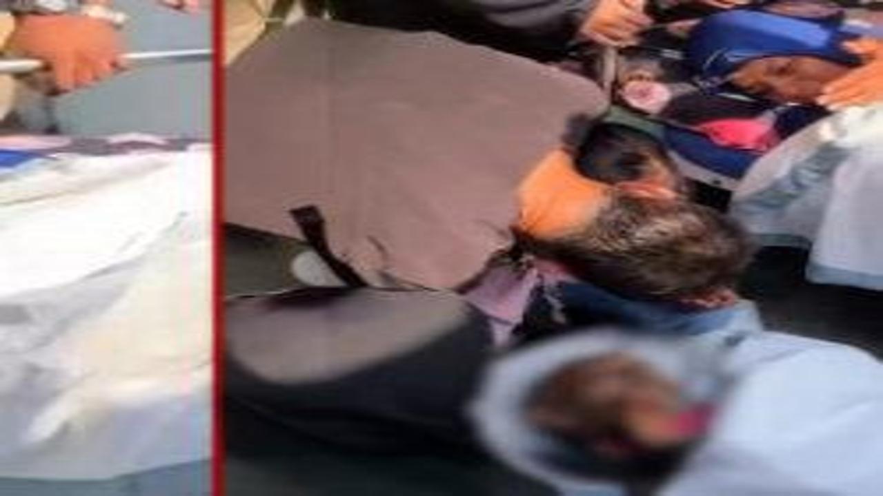 Yaralı kadından eşe son bakış! Dünya bu bakışı konuşuyor...