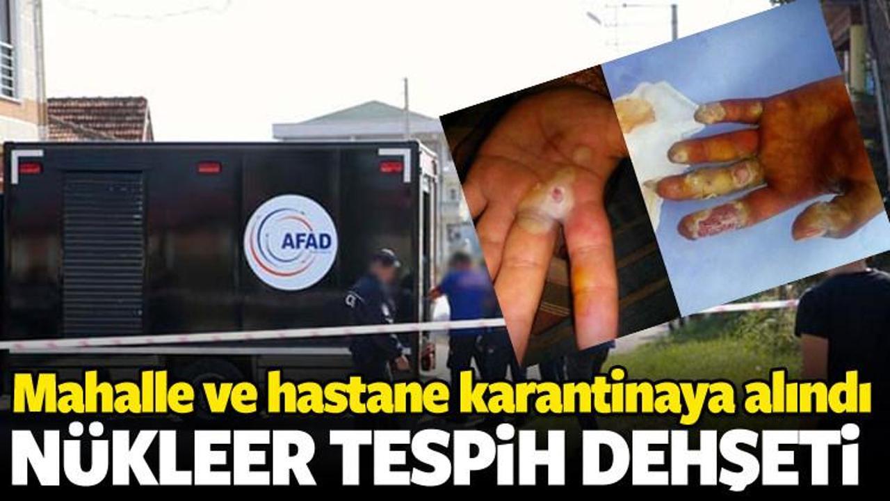 Nükleer ‘tespih’ hayatını kararttı!