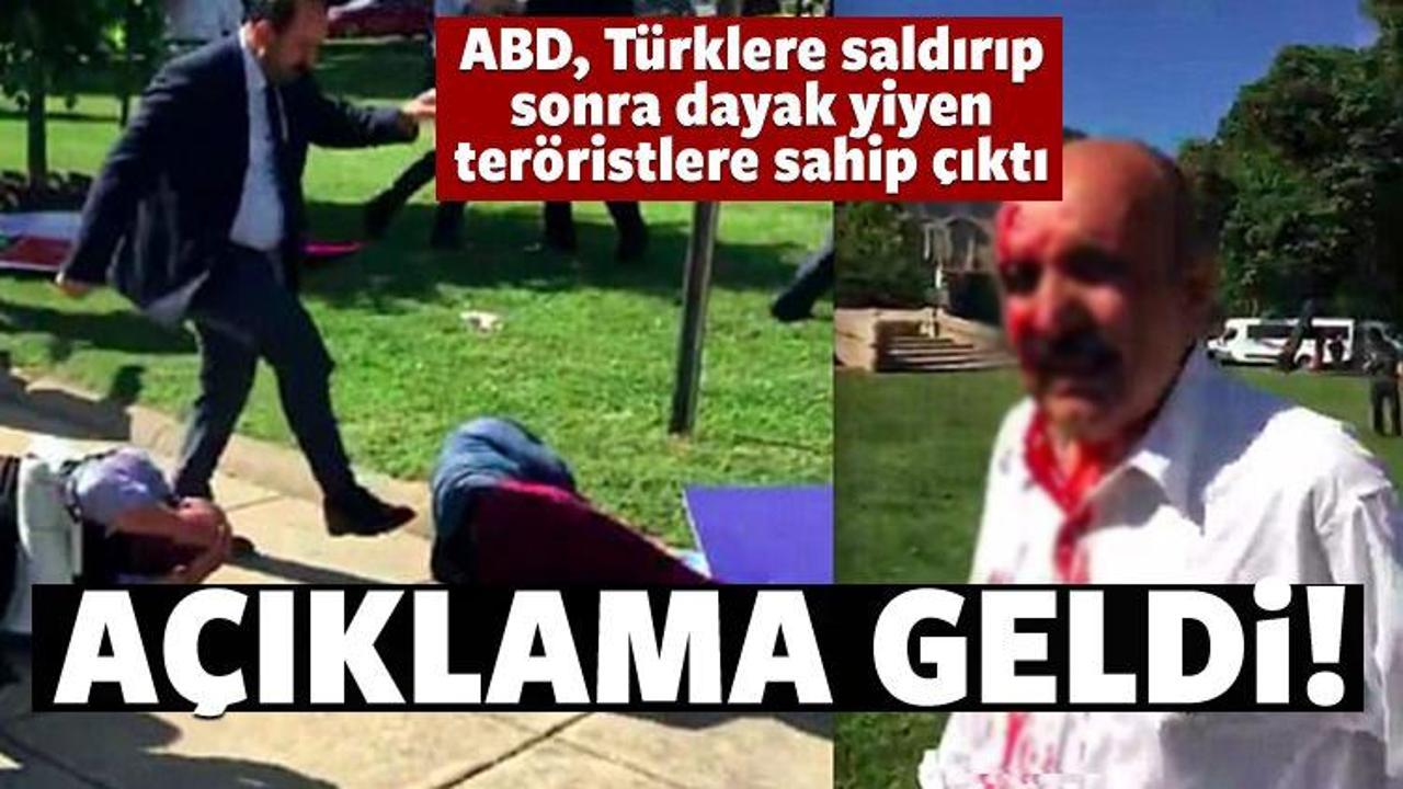 ABD, dayak yiyen ter&ouml;ristlere sahip &ccedil;ıktı