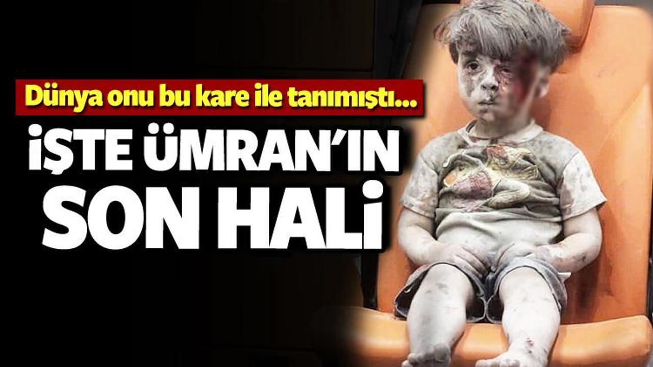 İşte Ümran Dakneş'in son hali