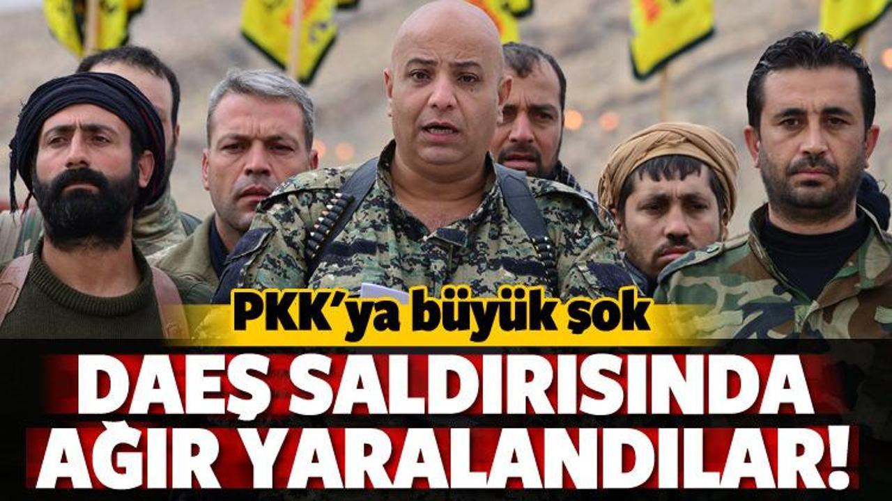 PKK'ya büyük şok! DAEŞ saldırısında ağır yaralandı