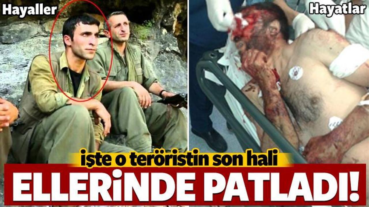 İşte o teröristin son hali!