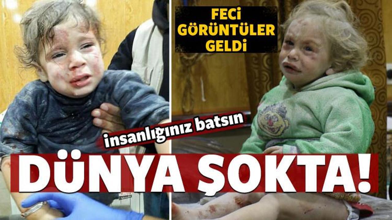 Feci g&ouml;r&uuml;nt&uuml;ler! D&uuml;nyayı şoke etti