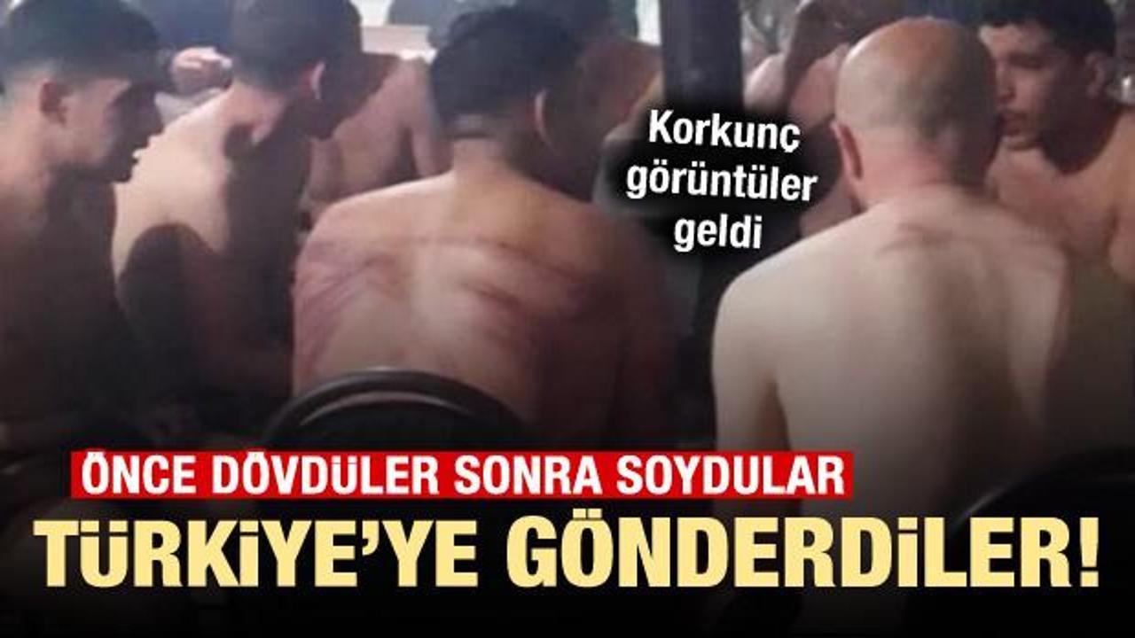 D&ouml;v&uuml;p soyup &ccedil;ıplak halde T&uuml;rkiye&rsquo;ye g&ouml;nderdiler