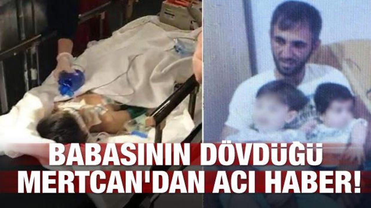 Babası tarafından dövülen Mertcan'dan acı haber