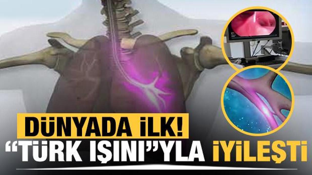 Dünyada ilk! Türk ışını tedavisiyle iyileşti