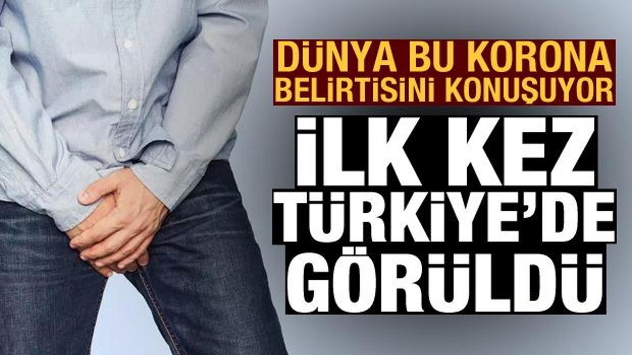 Dünya'da ilk kez Türkiye'de görüldü: Testis ağrısından Kovid-19 tanısı kondu