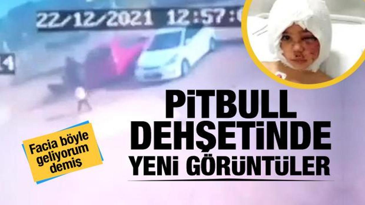 Facia böyle geliyorum demiş: Pitbull dehşetinde yeni görüntüler