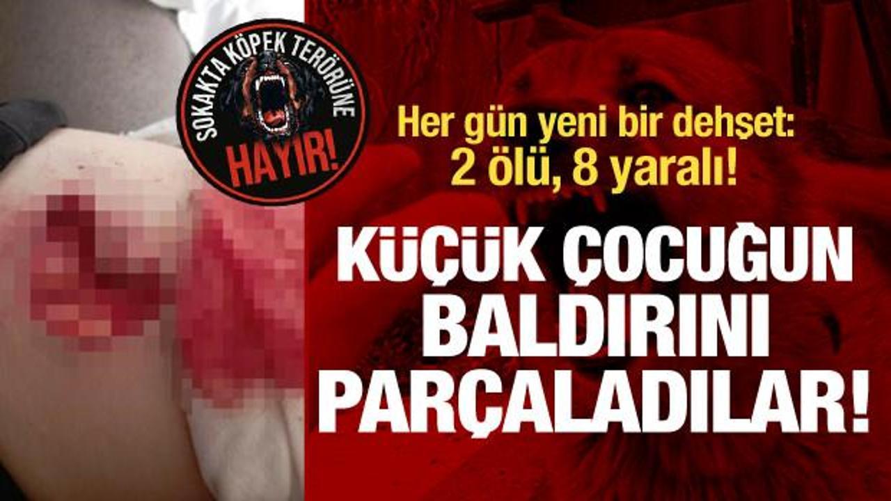Başıboş köpekler çocuğun bacağını parçaladı! Her gün yeni bir dehşet: 2 ölü 8 yaralı! 