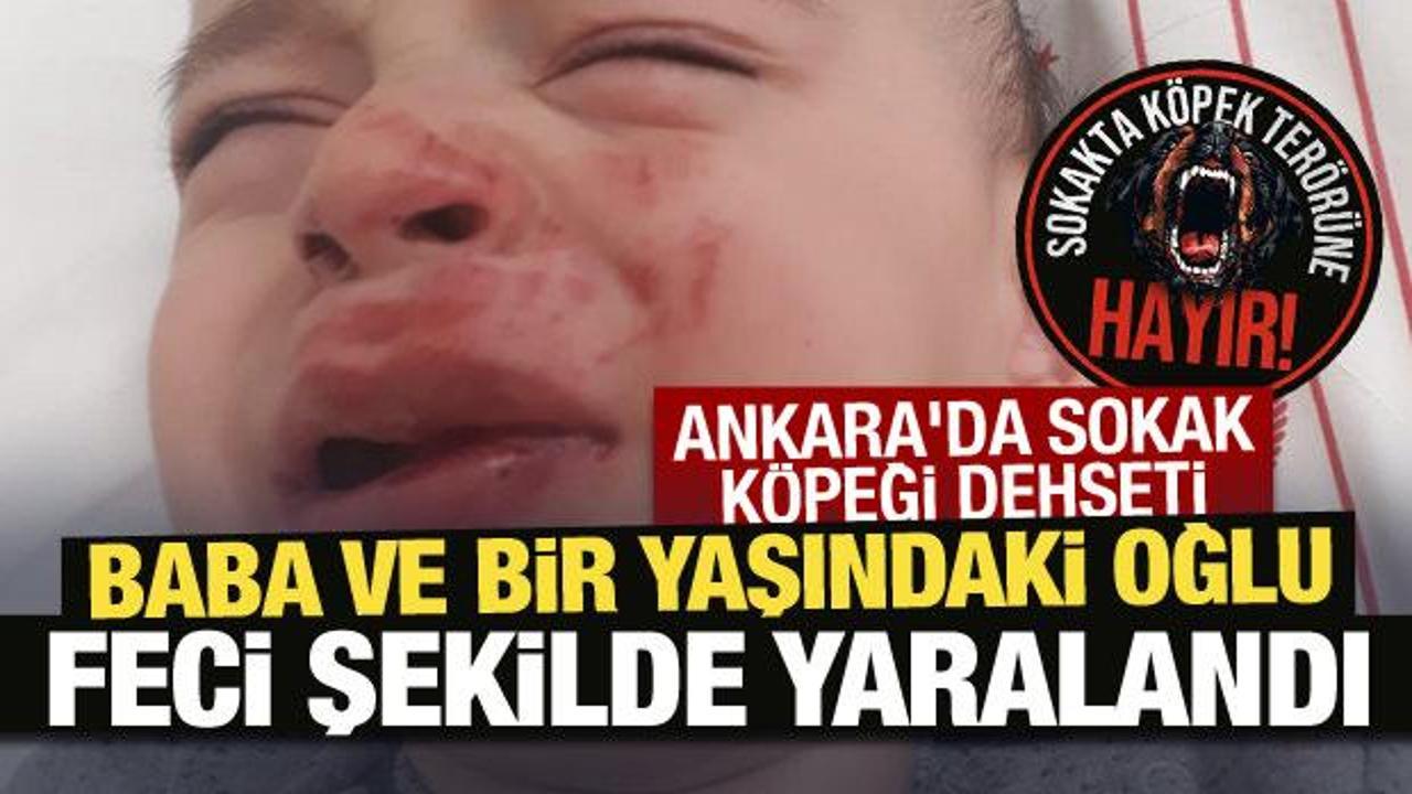 Ankara'da sokak köpeği dehşeti: Baba ve bir yaşındaki oğlu feci şekilde yarandı!