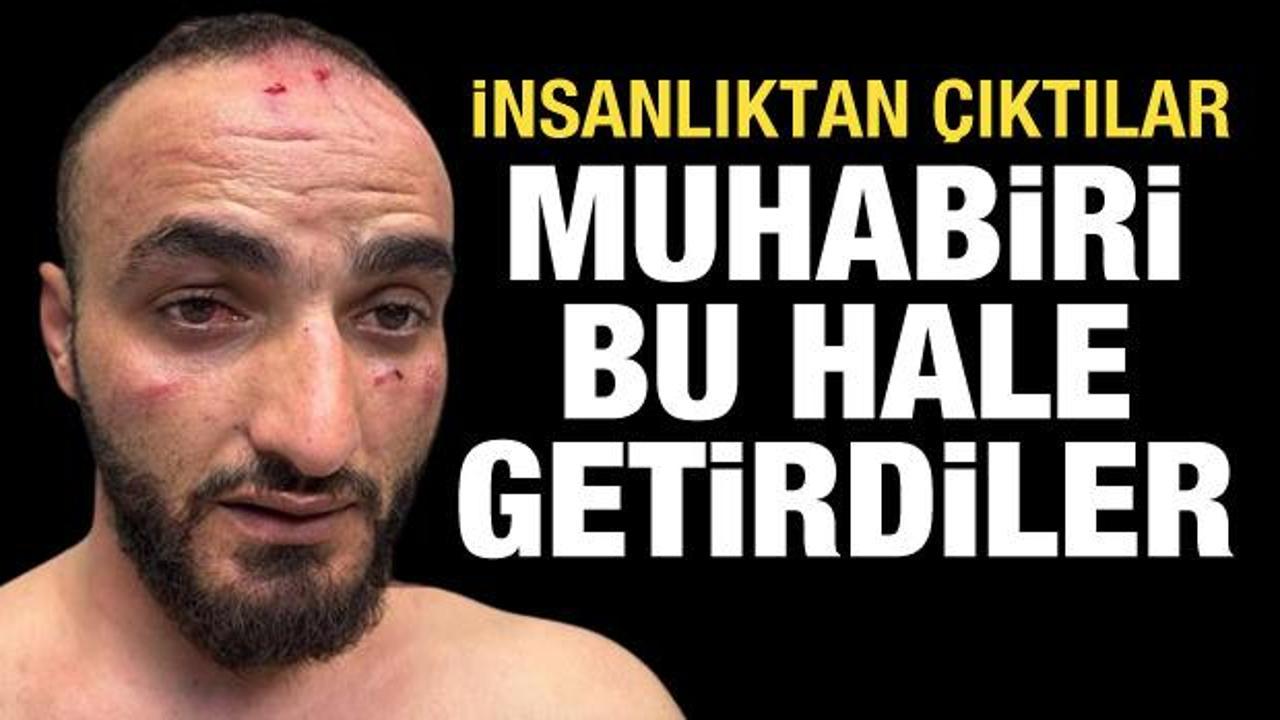 İsrail g&uuml;&ccedil;leri, AA foto muhabirini darbetti