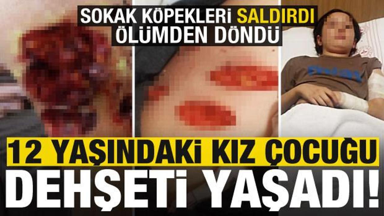 Sokak köpekleri 12 yaşındaki kız çocuğuna dehşeti yaşattı! Ölümden döndü