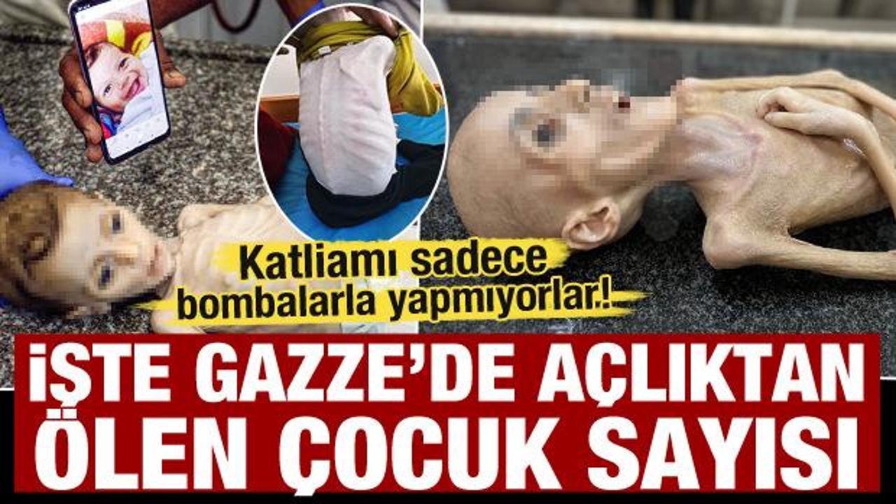 Gazze'de açlıktan ölen çocuk sayısı arttı! En küçüğü 14 günlük