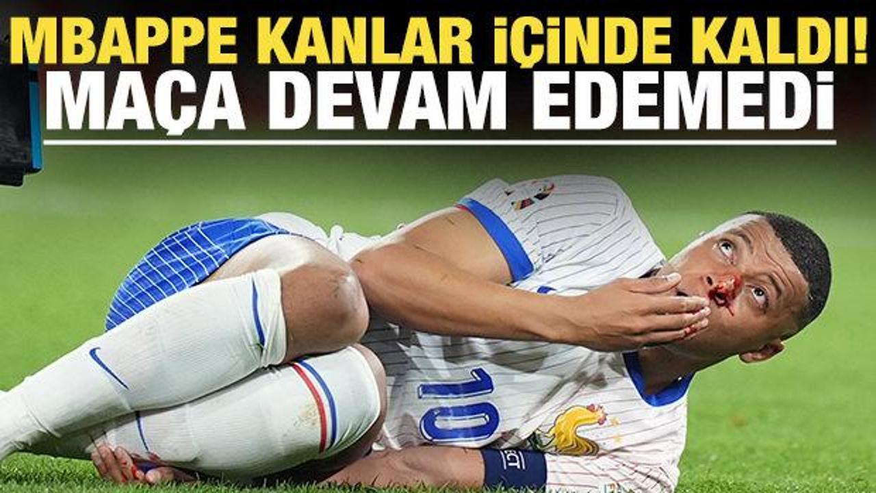 Kylian Mbappe kanlar içinde kaldı!