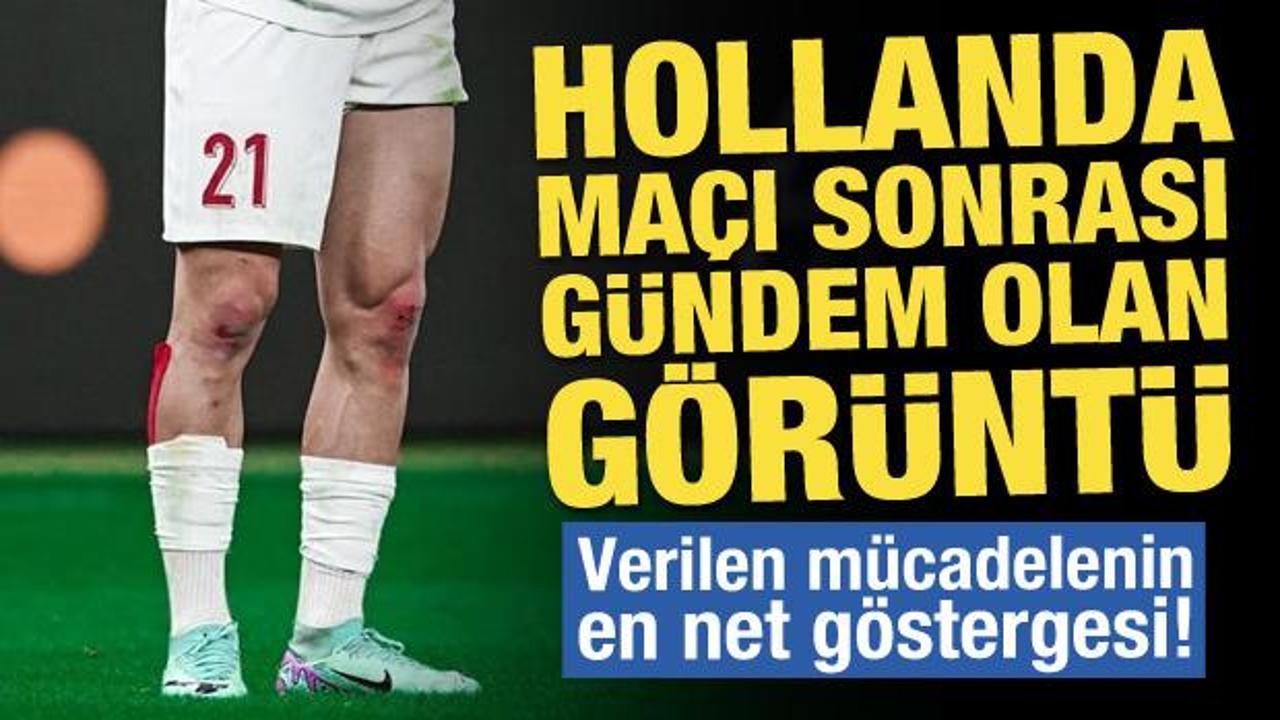 Hollanda ma&ccedil;ı sonrası g&uuml;ndem olan g&ouml;r&uuml;nt&uuml;! Verilen m&uuml;cadelenin g&ouml;stergesi