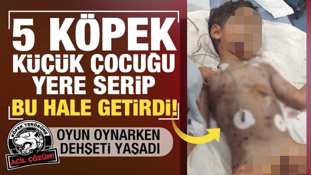 Başıboş köpekler dehşet saçtı! 5 yaşındaki çocuk ağır yaralandı