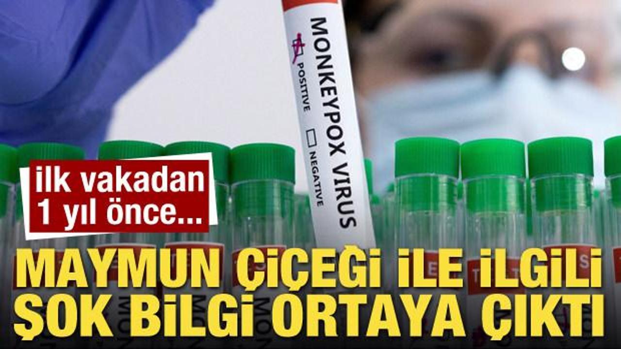 Maymun Çiçeği virüsüyle ilgili şok detay! 1 yıl önce anlatılmış