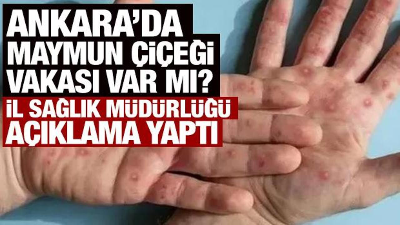 Son Dakika: Ankara'da maymun &ccedil;i&ccedil;eği karantinası iddiasına yanıt!