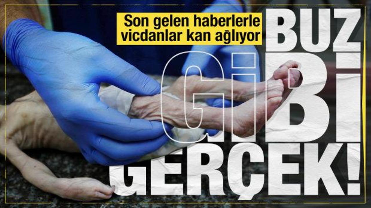 Gazze'de donarak şehit olan bebeklerin sayısı gün geçtikçe artıyor