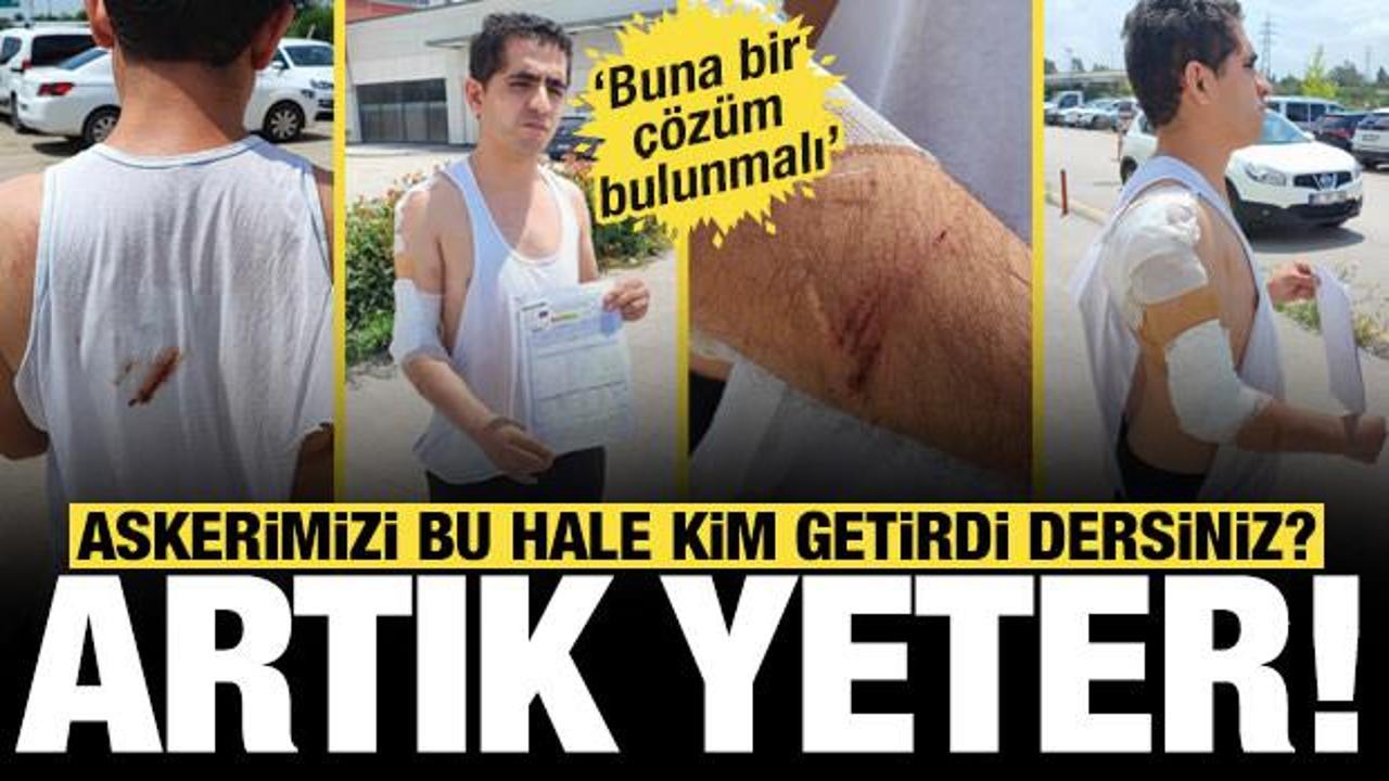 Adana’da memleketine izinli gelen asker kurt köpeğinin saldırısına uğradı