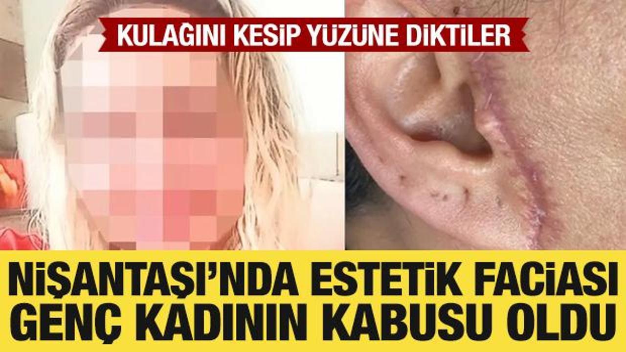 Estetik ameliyatı genç kadının kabusu oldu: Kulağını kesip yüzüne diktiler