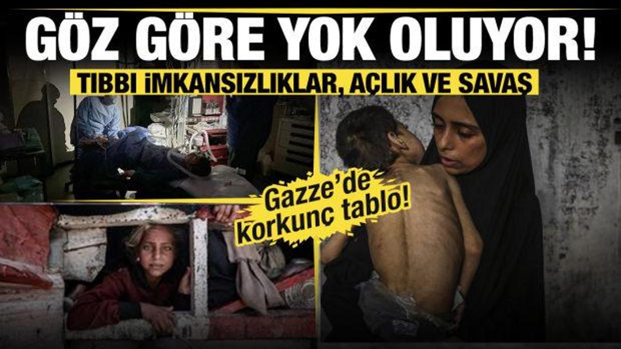 Tıbbı imkansızlıklar, a&ccedil;lık ve savaş... Gazze g&ouml;z g&ouml;re g&ouml;re yok oluyor!