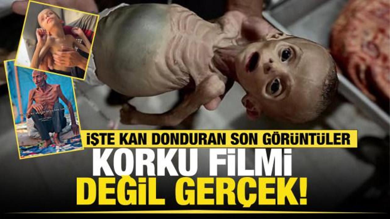 İnsanlık Gazze'de sınıfta kaldı! A&ccedil;lıktan &ouml;lenlerin yarısından fazlası &ccedil;ocuk! 