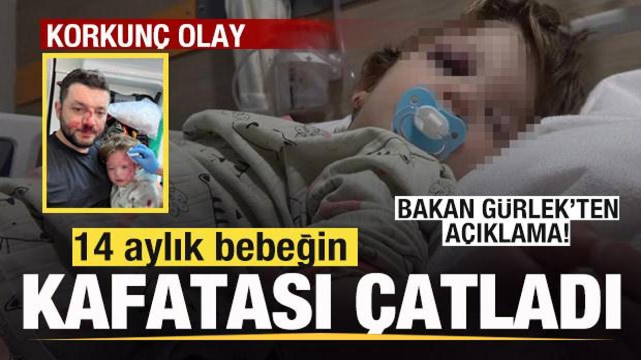 Korkun&ccedil; olay! 14 aylık bebeğin kafatası &ccedil;atladı! Bakan G&uuml;rlek'ten son dakika a&ccedil;ıklaması