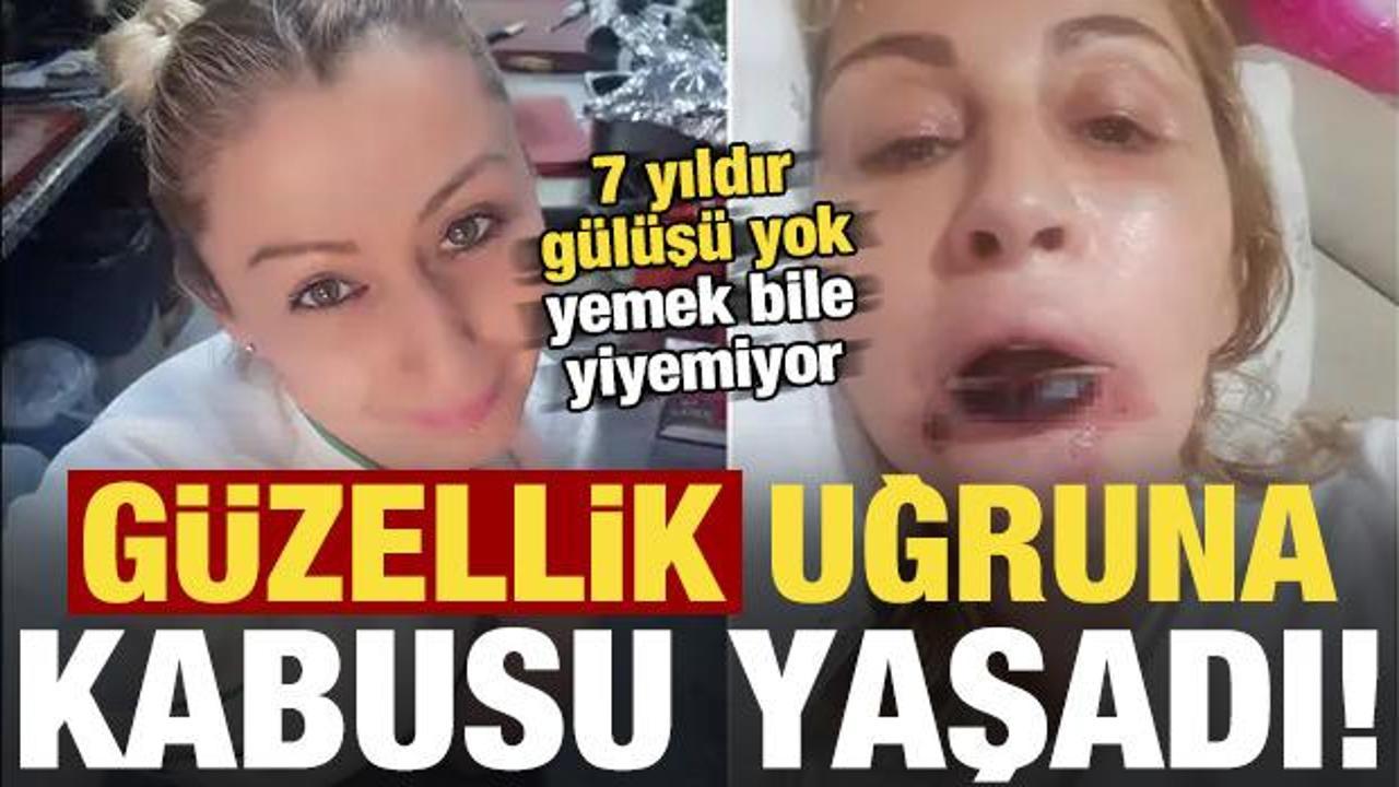 Yaptırdığı işlem sonrası dudağı &ccedil;&uuml;r&uuml;d&uuml;! 7 yıldır kabusu yaşıyor...