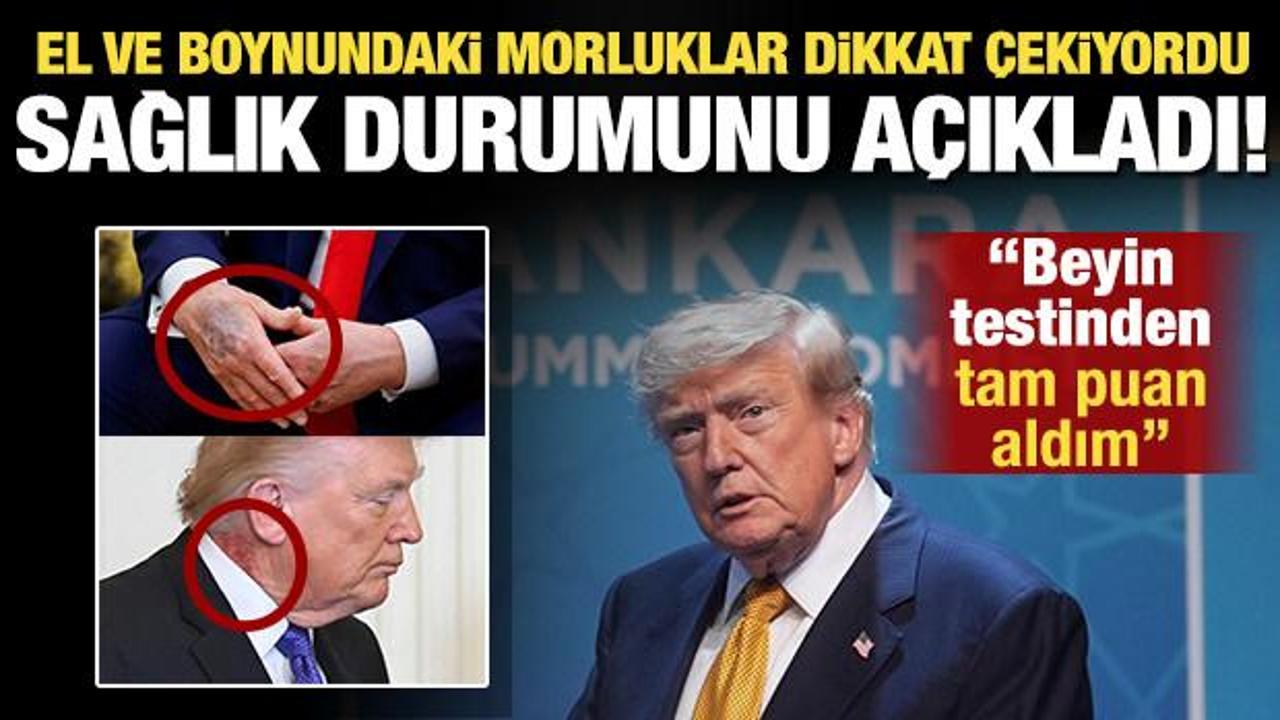 Trump'ın sağlık durumu nasıl? Boynundaki morluklar dikkat &ccedil;ekmişti: 'Tam puan aldım'