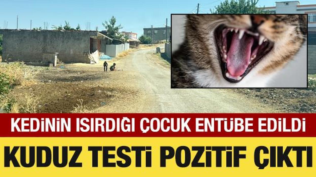 Kedinin ısırdığı 4 yaşındaki &ccedil;ocuk ent&uuml;be edildi! Kuduz testi pozitif &ccedil;ıktı