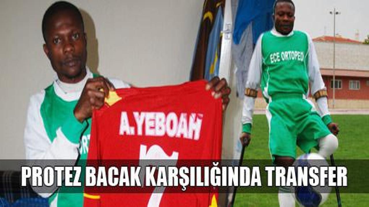 Protez bacak karşılığında transfer