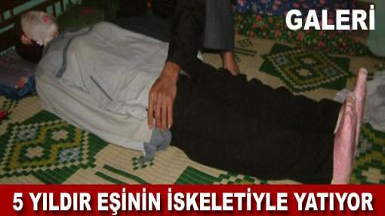 5 yıldır karısının iskeletiyle yatıyor Galeri