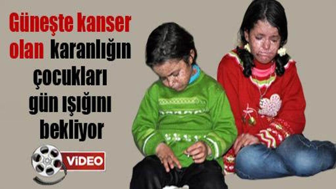 Güneşte kanser olan kızlar ışığı bekliyor