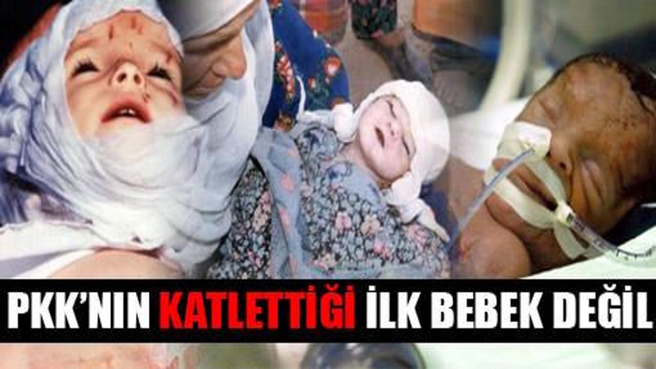PKK'nın katlettiği ilk bebek değil!
