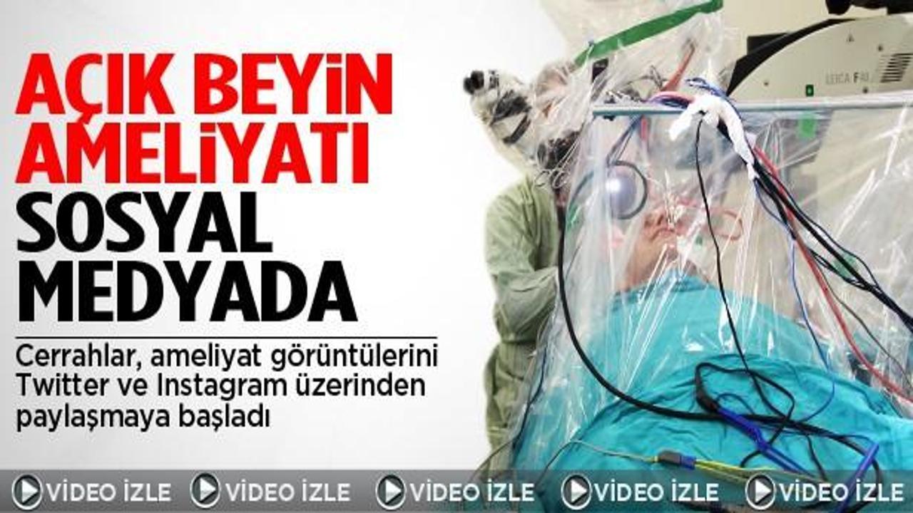 Açık beyin ameliyatı sosyal medyada