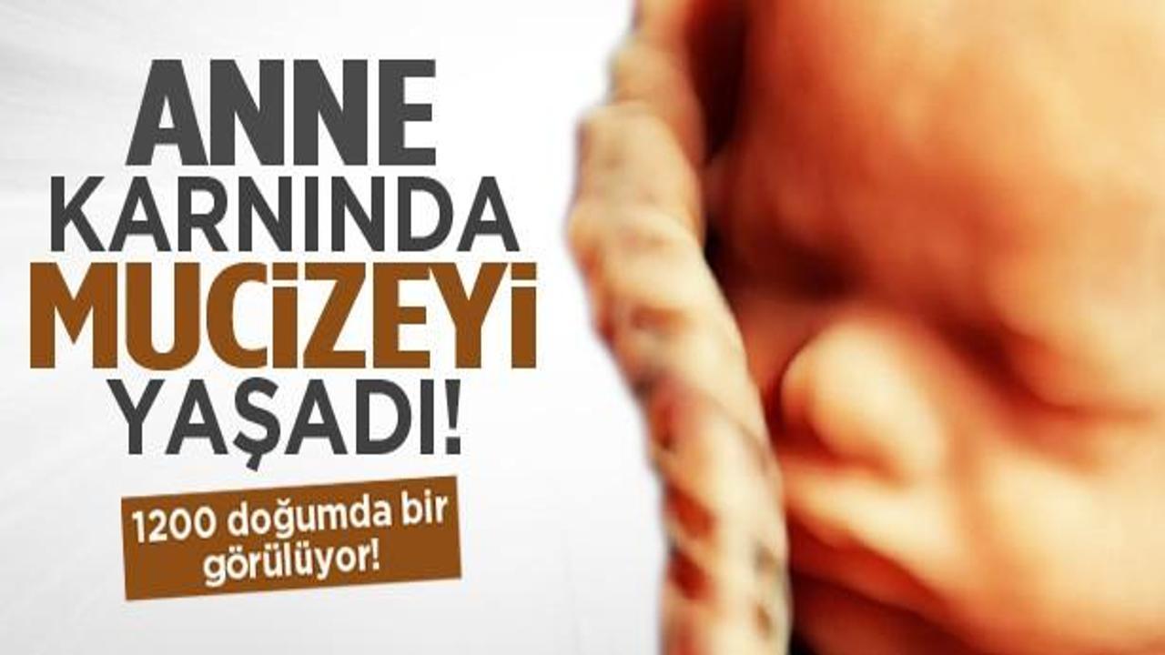 Anne karnında mucizeyi yaşadı
