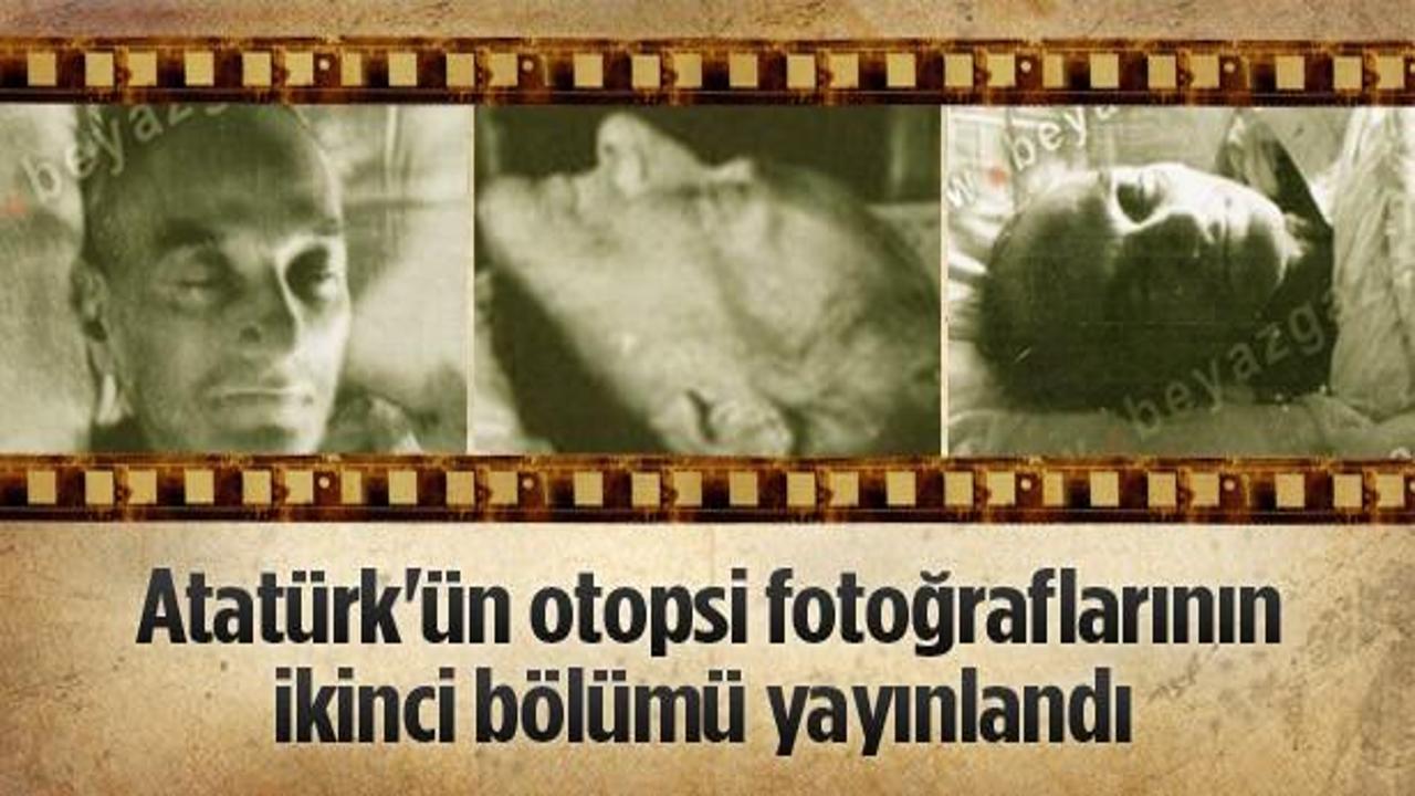 Atatürk'ün otopsi fotoğraflarının 2. bölümü