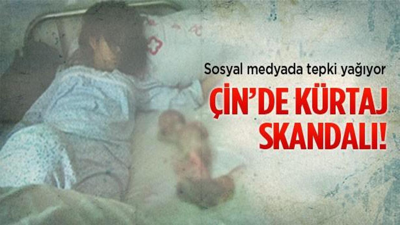 Çin'de kürtaj skandalı