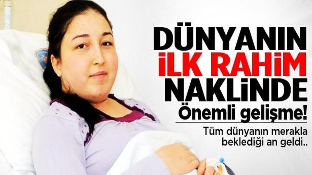 Dünyanın ilk rahim naklinde önemli gelişme