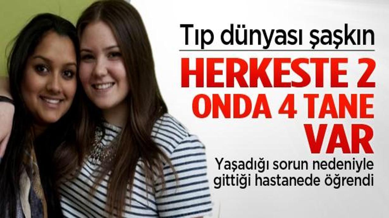 Herkeste 2 tane bu kızda 4 tane!