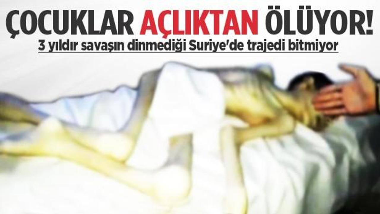 Suriye'de çocuklar açlıktan ölüyor