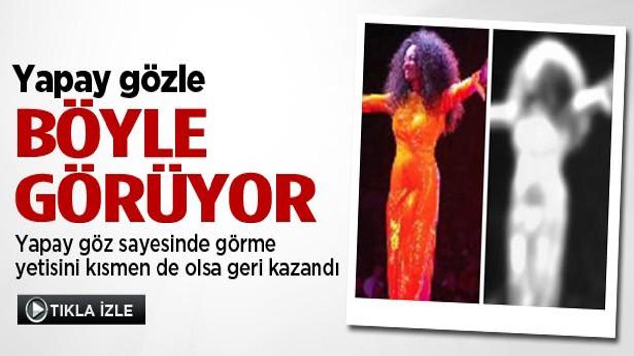 Yapay gözle böyle görüyor