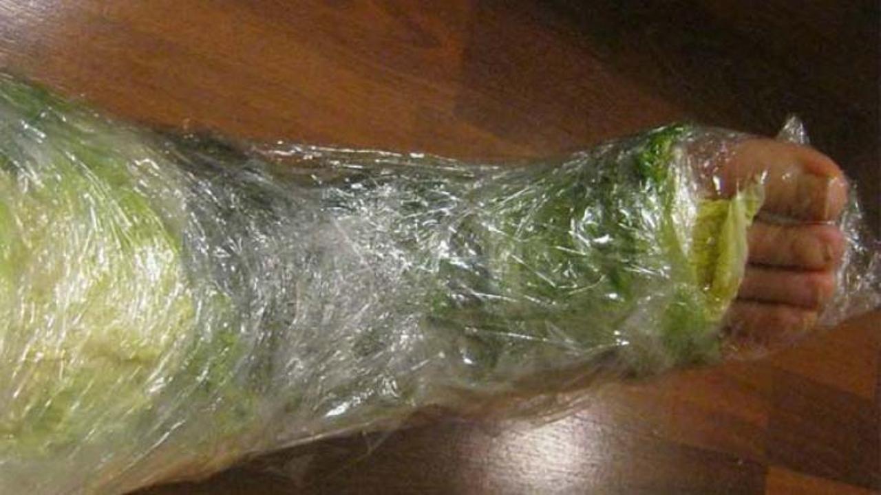 Капустный лист вытянуть. Капустный лист вытянуть. Компресс из листьев лопуха. Капуста для голубцов овальная. Компресс из капустных листьев.