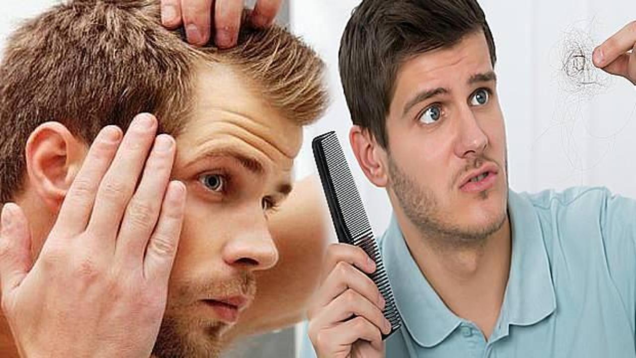 Aşırı saç dökülmesine ne iyi gelir | Erkeklerde tepeden durmayan saç