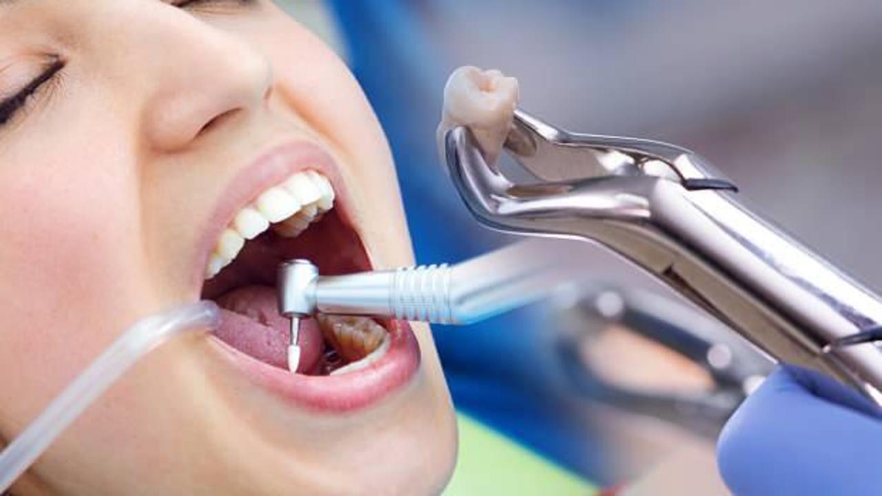 Rüyada diş çektirmek neye işarettir? Rüyada çürük diş çektirmek hayırlı