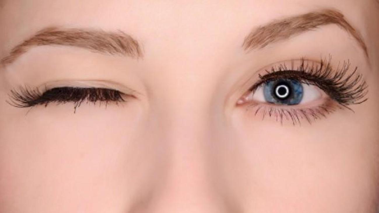 Goz Segirmesi Neden Olur Saglik Haberleri